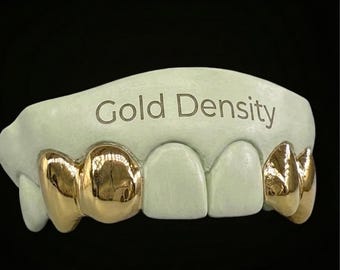Puede incluir: Una rejilla dental dorada con el texto "Gold Density" grabado en la parte superior. La rejilla presenta tapas doradas en los dientes delanteros, sobre un fondo negro.