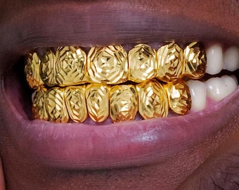 Puede incluir: Primer plano de una boca con dientes de oro. Los dientes son de color oro brillante y tienen un diseño geométrico facetado. Los labios de la persona son de color rosa oscuro, y los dientes contrastan fuertemente con los dientes naturales.