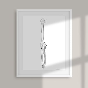 Ulna Radius Print, Humerous, Anatomical, Clinical Decor, Osteopathy, Osteology, Orthopedic, Medical Illustration, Waiting Room Art,