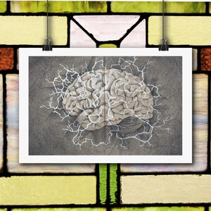 May include: A rectangular art print featuring a detailed, beige-toned human brain illustration centered on a dark, cross-hatched gray background. Bright white, jagged lightning-like lines radiate outward from the brain across the dark surface.