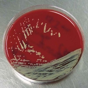 Puede incluir: Una placa de Petri transparente con agar rojo. Colonias bacterianas beige salpican el agar. Se observa una zona más clara de crecimiento bacteriano a lo largo del borde inferior del plato.