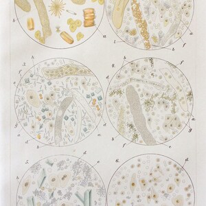 Vintage 1905 German Medical Diagram Bookplate KIDNEY BLADDER DISEASE Microscopic Magnification