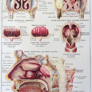 1920s Francés Anatomía Humana Disección Bookplate NOSE Imprimir Diagrama Médico