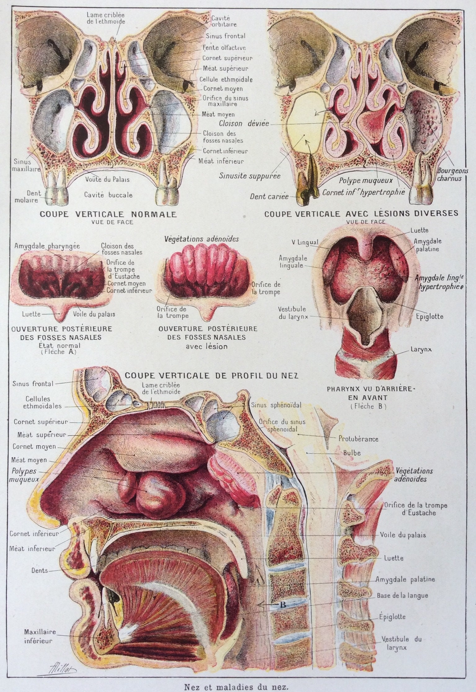 Lehrbuch Der Allgemeinen Pathologie Und Der Pathologischen