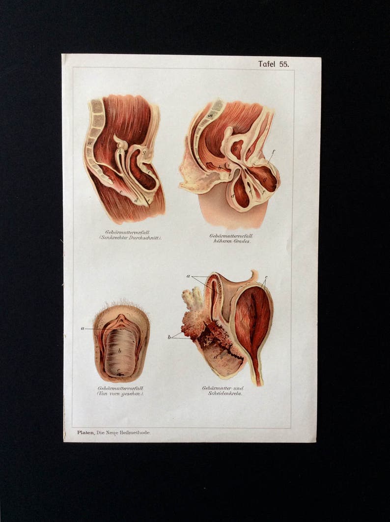 Anatomie médicale allemande 1905 Vintage schéma exlibris Etsy