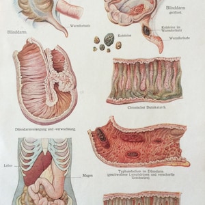 Antique Print 1920s German Medical Anatomy Organs INTESTINAL DISEASES Diagram Bookplate