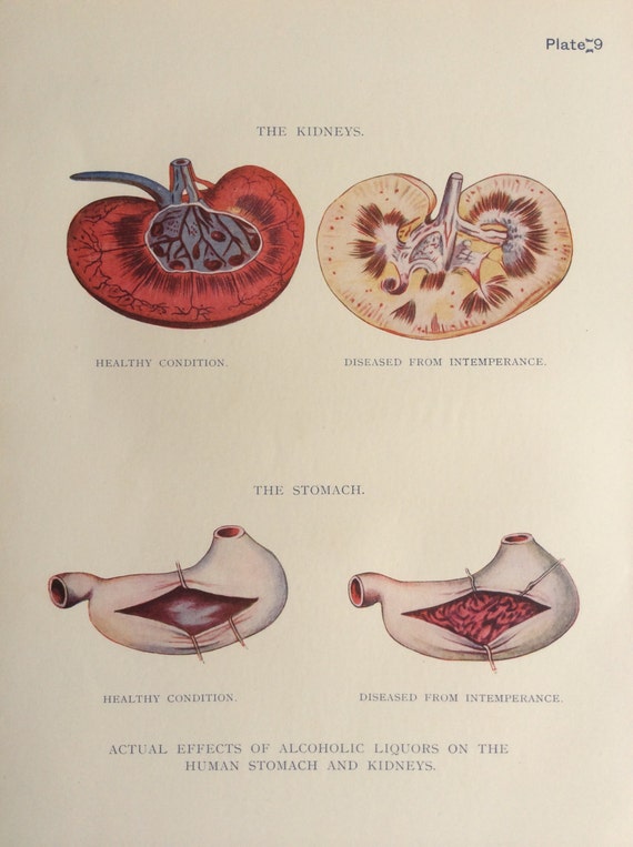 Anatomia Człowiek Ilustracja Nerki Narządu Rysunek żołądek Schemat Rozwarstwienie Medycyna Wpływ Alkoholu Na Ciało