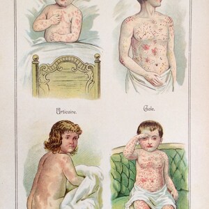 Antikes Französisches Buchschild 1900er MALADIES des enfants Kinder Hauterkrankungen Chromolithographie Vintage Medizinisches Diagramm 1909