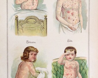 Antique Print French Bookplate 1900s MALADIES des enfants Childrens Skin Disease Chromolithograph Vintage Medical Diagram 1909