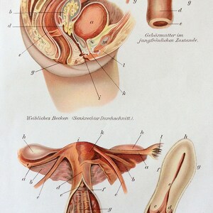 Antique Print  1905 UTERUS German Medical Anatomy Diagram Bookplate FEMALE Woman Dissection