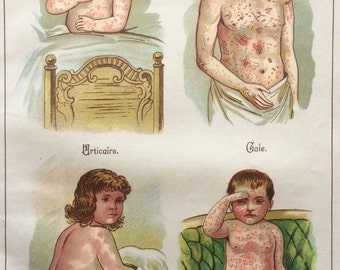 Antique Print French Bookplate Print MALADIES des enfants Childrens Skin Disease Chromolithograph Victorian Vintage Medical Diagram 1900