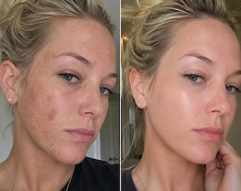 Luxury Dark Spot Cream for Face & Body