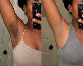 Underarm & Inner Thigh Brightening Cream
