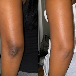 Sichere Helle Creme | Hyperpigmentierung Creme | Hellt stumpfe Haut auf Gerader Hautton | Gesichts- und Körperpflege