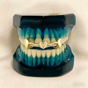 Puede incluir: Un modelo dental con una rejilla dorada. La rejilla presenta un diseño en forma de corazón con una pequeña gema en el centro. Los dientes son de color crema, colocados en una base translúcida azul y verde.