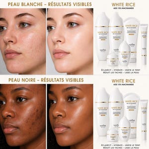 May include: Image of a skincare product line with the text "WHITE RICE ADD 15% NIACINAMIDE". The products are in white bottles and tubes. The image also shows before and after photos of skin, with the text "PEAU BLANCHE - R&Eacute;SULTATS VISIBLES" and "PEAU NOIRE - R&Eacute;SULTATS VISIBLES".