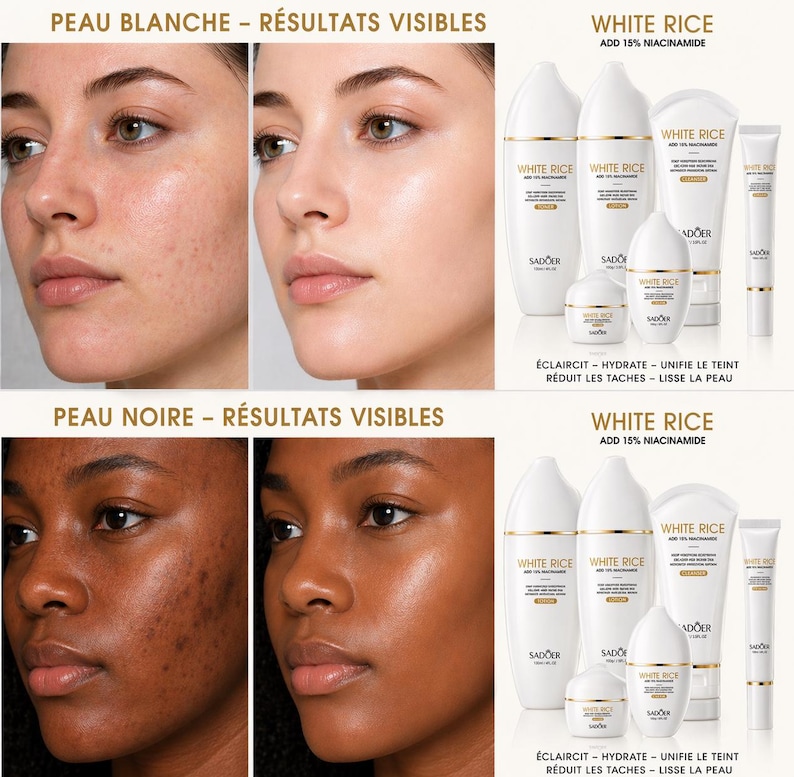 May include: Image of a skincare product line with the text "WHITE RICE ADD 15% NIACINAMIDE". The products are in white bottles and tubes. The image also shows before and after photos of skin, with the text "PEAU BLANCHE - R&Eacute;SULTATS VISIBLES" and "PEAU NOIRE - R&Eacute;SULTATS VISIBLES".
