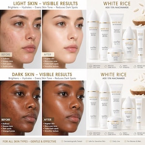 May include: An advertisement for a skincare product featuring before-and-after photos of light and dark skin. The product line, "WHITE RICE," includes various creams and lotions, with text indicating it brightens, hydrates, and reduces dark spots. The product is for all skin types.