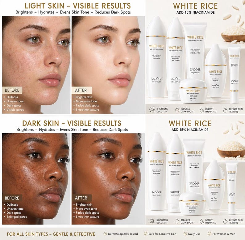 May include: An advertisement for a skincare product featuring before-and-after photos of light and dark skin. The product line, "WHITE RICE," includes various creams and lotions, with text indicating it brightens, hydrates, and reduces dark spots. The product is for all skin types.