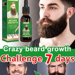 May include: A brown glass bottle of beard growth essence with a black dropper, a green and white box, and the text "Crazy beard growth Challenge 7 days". The product promises to protect healthy hair growth.