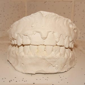 Vintage Teeth Impression plaster tooth casting dental