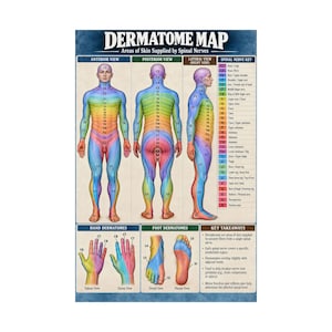 May include: A dermatome map poster titled Areas of Skin Supplied by Spinal Nerves. It displays anterior, posterior, and lateral views of a human figure color-coded by spinal nerve segments, with detailed hand and foot diagrams and a key.