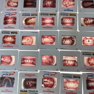 May include: A collection of 16 Kodak film slides, each featuring a close-up of a person's teeth. The slides are arranged in a grid pattern and are labeled with the type of film used, the date, and the processing information.