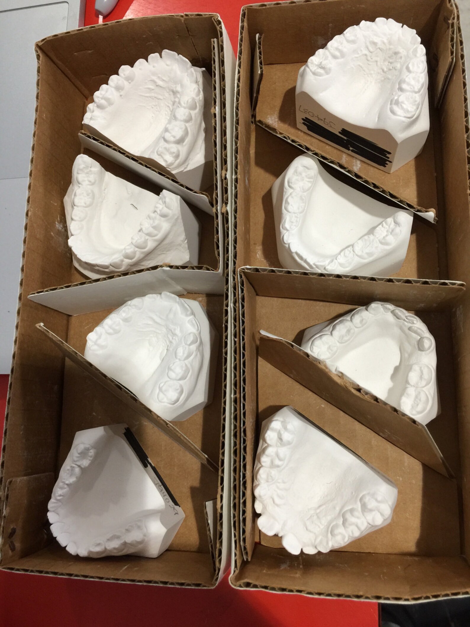 Creepy Vintage Dental Teeth Molds Old Dentist Tooth Mold Etsy