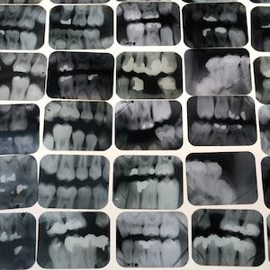 Vintage Dental xrays - lot of 5 -old dentist tooth films- teeth xray- Halloween vintage dental prop oddity dental