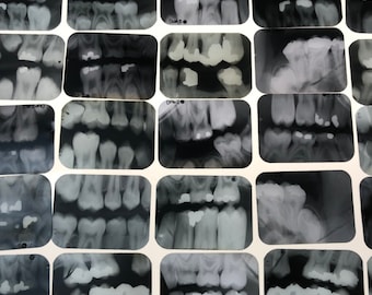 Vintage Dental xrays - lot of 5 -old dentist tooth films- teeth xray- Halloween vintage dental prop oddity dental