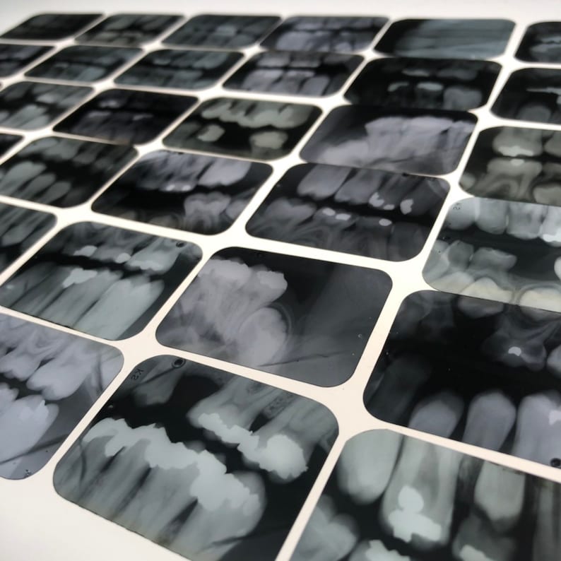 Vintage Dental Xrays Lot of 5 old Dentist Tooth Films Etsy