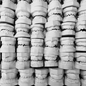 Creepy Vintage Dental teeth molds - old dentist tooth mold - articulated dental mold sets - Halloween vintage dental prop oddity dental