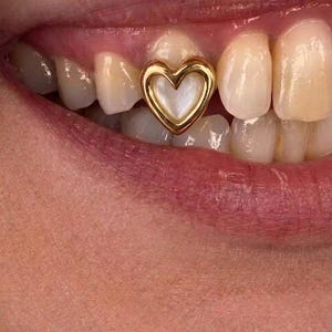 Puede incluir: Un adorno dental dorado con forma de corazón y una incrustación blanca nacarada. El adorno en forma de corazón está fijado sobre la superficie de un diente superior, con un borde metálico liso y un centro brillante e iridiscente.
