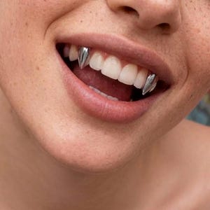 May include: A pair of silver-coloured metal tooth caps shaped like pointed fangs, securely fitted over the upper lateral incisors. The metallic caps have a smooth, reflective surface that contrasts with the natural white enamel of the teeth.