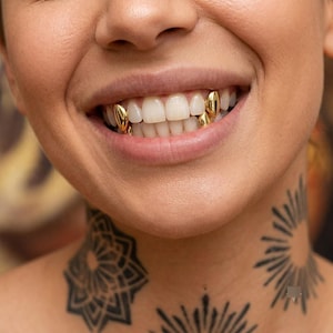 May include: A set of gold tooth caps worn on the upper canine teeth. The metallic gold covers are smooth and polished, fitted securely over the natural teeth, creating a distinct reflective appearance against the natural white tooth enamel.