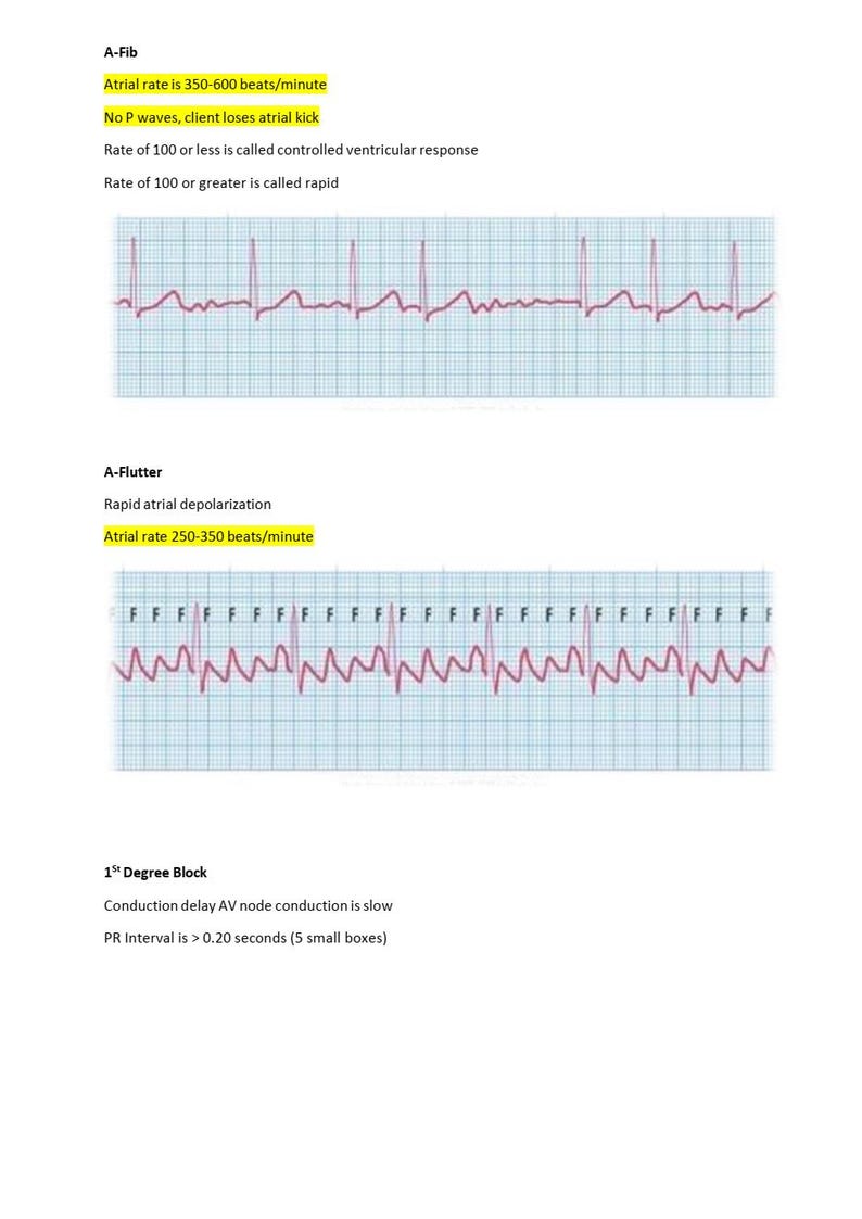 The Relias Dysrhythmia Basic B Practice | Questions and Verified ...