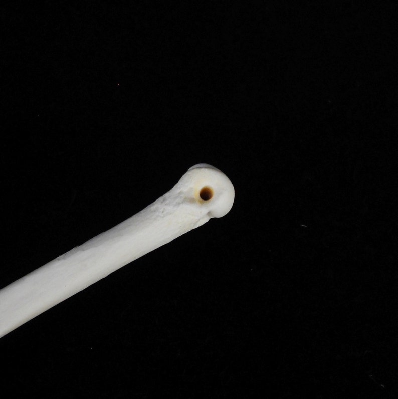 May include: Close-up of the end of a white bone with a small hole in the center.