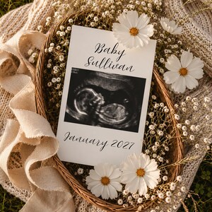 Digital Pregnancy Announcement Template, Neutral Floral, Editable Canva Sonogram Reveal (Digital Download)