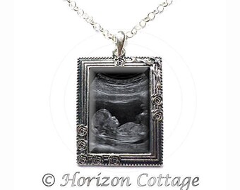 Aangepaste echografie, aangepaste Sonogram, Picture Frame ketting, antieke zilveren Vintage Look, uw eigen echografie