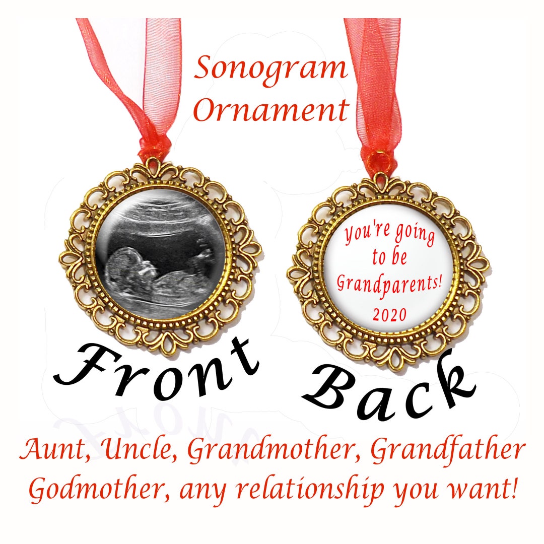 Baby Announcement Ornament Using Your Own Sonogram or Ultrasound