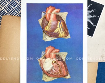 1930s Heart Dissection, Not Reproduction, Vintage Medical Scientific Anatomy, Antique Home Decor