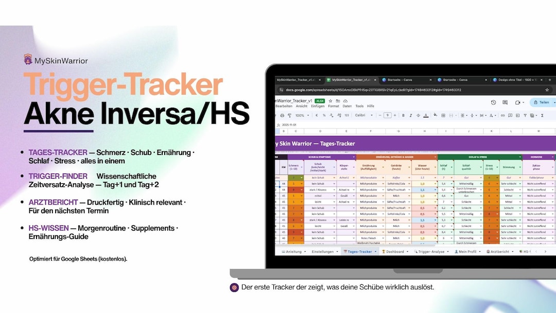 Trigger Tracker Acne Inversa/hs - Etsy UK