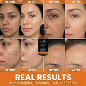 HealthyAsia Super Vitamin C Serum – Sérum facial antiedad, iluminador y reafirmante imagen 7