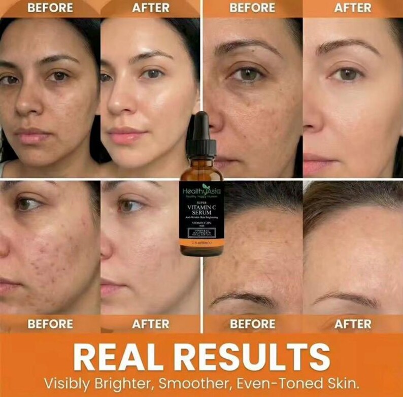 HealthyAsia Super Vitamin C Serum – Sérum facial antiedad, iluminador y reafirmante imagen 7