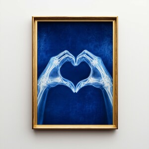 May include: A framed print featuring an X-ray image of hands forming a heart shape. The hands are depicted in white against a deep blue background. The frame is gold-colored, adding a touch of elegance to the artwork.