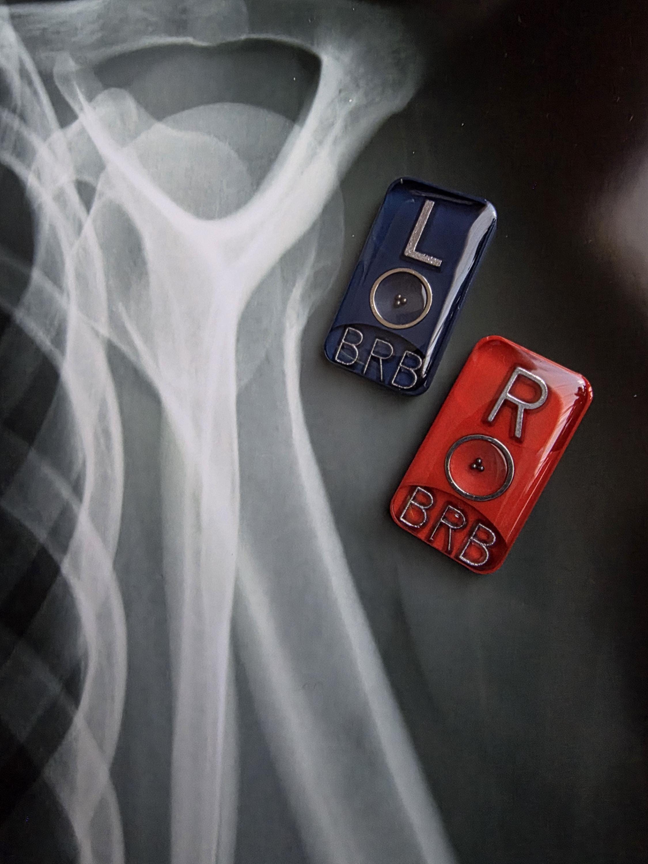 X Ray Markers Red and Blue - Etsy