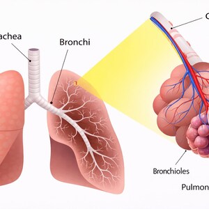 May include: Anatomy illustration of the human respiratory system. The image shows the trachea, bronchi, bronchioles, pulmonary alveolus, and capillaries. The lungs are a pinkish-red color, and the bronchioles and alveoli are a darker shade of red and purple.