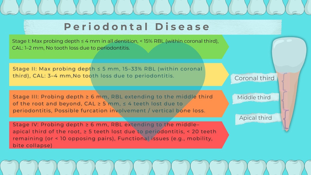 Periodontal Staging Grading Chart | Periodontitis Classification Dental ...