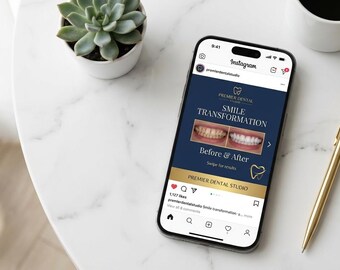 Dental Instagram Templates | 30 Editable Canva Posts for Dentists | Dental Marketing, Smile Transformation, Orthodontist Social Media