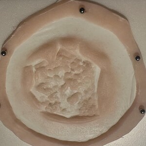 May include: A prosthetic wound appliance with a textured, flesh-toned center and a raised, rounded border. Small, dark metal studs are evenly spaced around the perimeter, securing the piece to a white base.